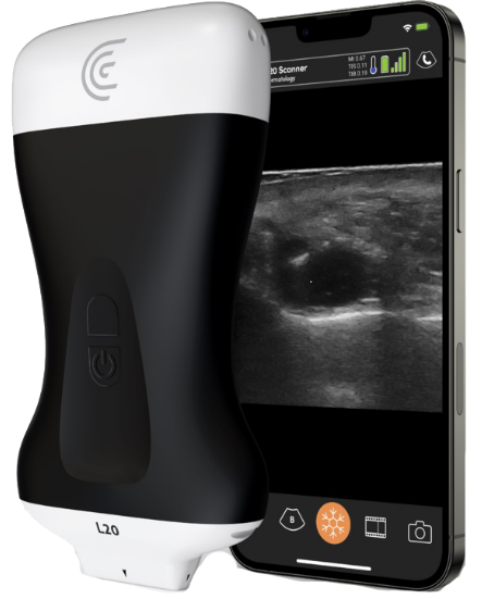 Ecografía Inalámbrica de Alta Resolución