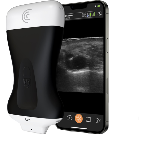 Ecógrafo Portátil Inalámbrico Lineal